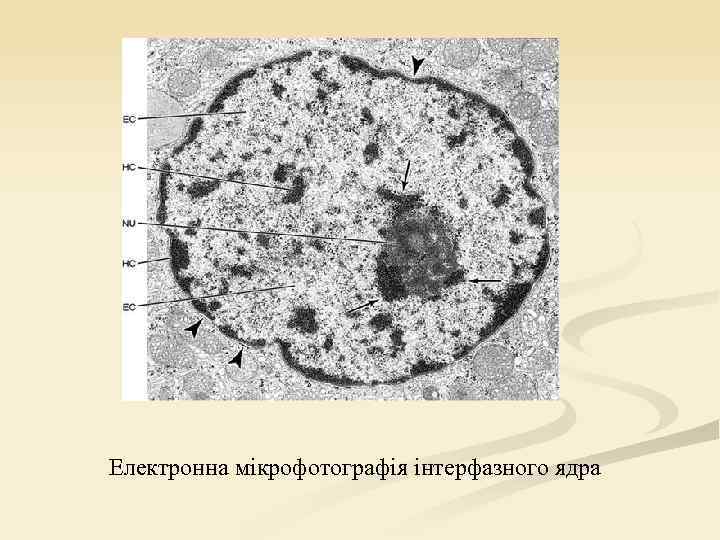 Електронна мікрофотографія інтерфазного ядра 