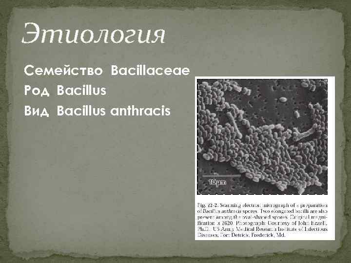 Этиология Семейство Bacillaceae Род Bacillus Вид Bacillus anthracis 