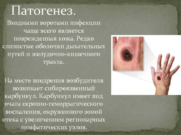 Патогенез. Входными воротами инфекции чаще всего является поврежденная кожа. Редко слизистые оболочки дыхательных путей