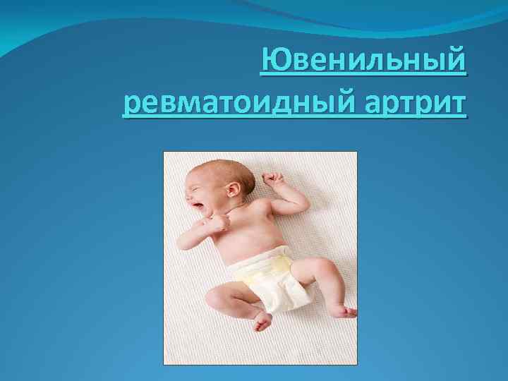 Ювенильный ревматоидный артрит 