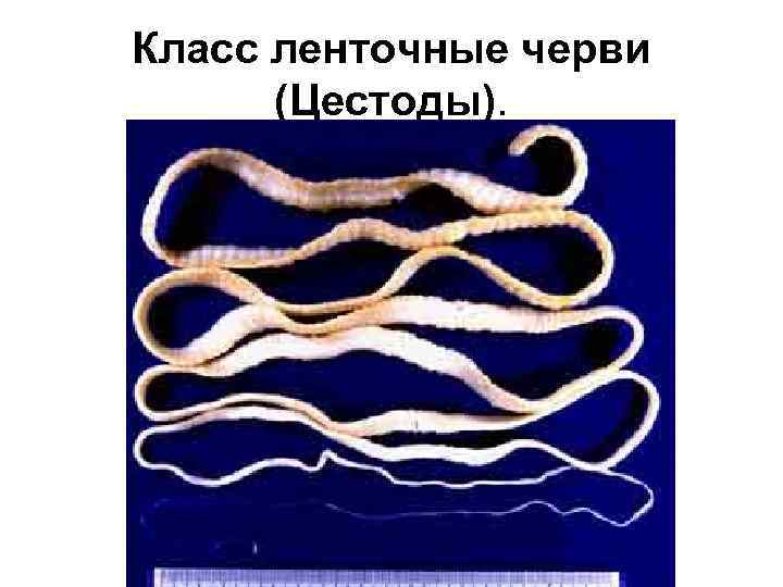 Класс ленточные черви (Цестоды). 