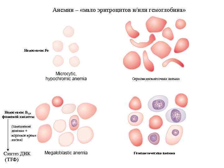 Анемия виды