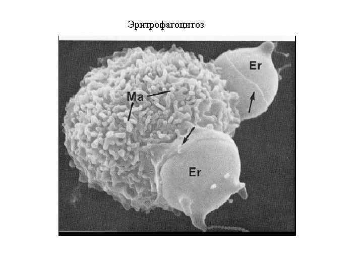 Эритрофагоцитоз 