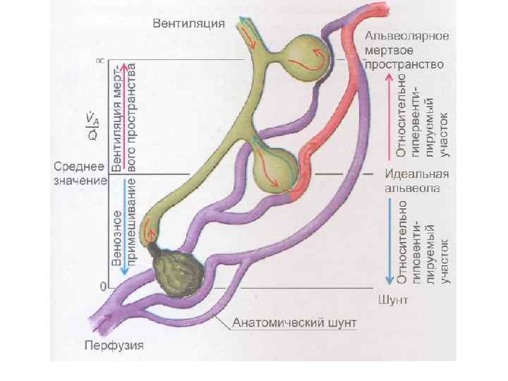 Мертвое пространство