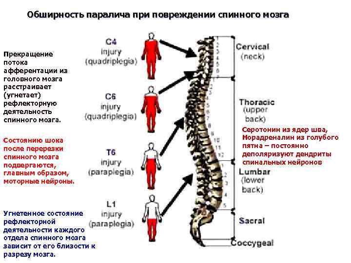 Болезни позвоночника которые отражаются на ногах. Уровни поражение отделов спинного мозга. Поражение спинного мозга на уровне грудного отдела. Признак повреждения спинного мозга при травмах позвоночника. Реабилитация после травмы спинного мозга грудного отдела.