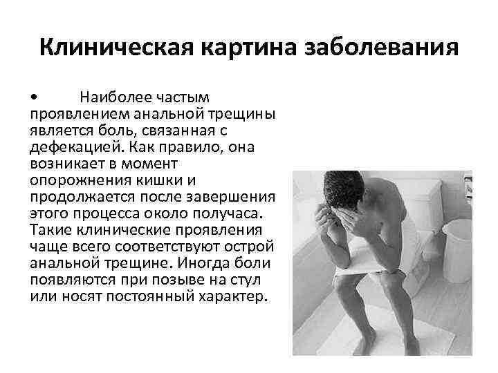 Клиническая картина заболевания • Наиболее частым проявлением анальной трещины является боль, связанная с дефекацией.