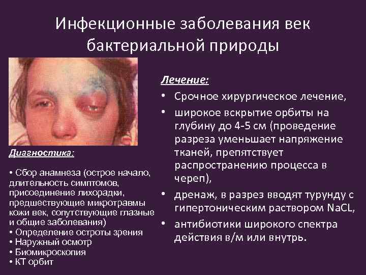 Инфекционные заболевания век бактериальной природы Диагностика: • Сбор анамнеза (острое начало, длительность симптомов, присоединение