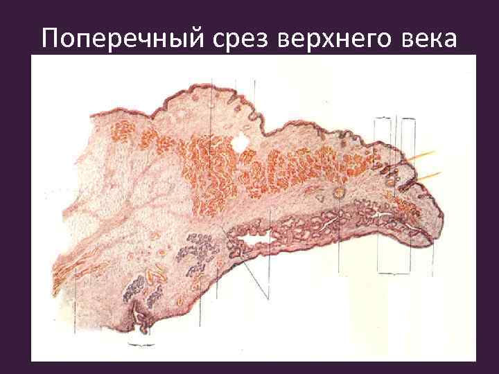 Поперечный срез верхнего века 