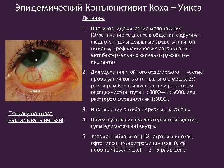 Эпидемический Конъюнктивит Коха – Уикса Лечение. 1. Противоэпидемические мероприятия (Ограничение пациента в общении с