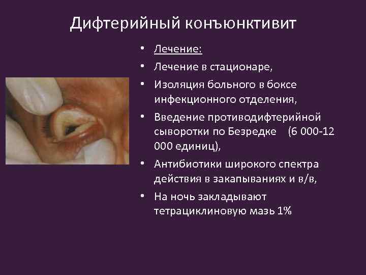 Дифтерийный конъюнктивит • Лечение: • Лечение в стационаре, • Изоляция больного в боксе инфекционного