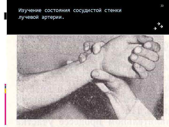 Изучение состояния сосудистой стенки лучевой артерии. 33 