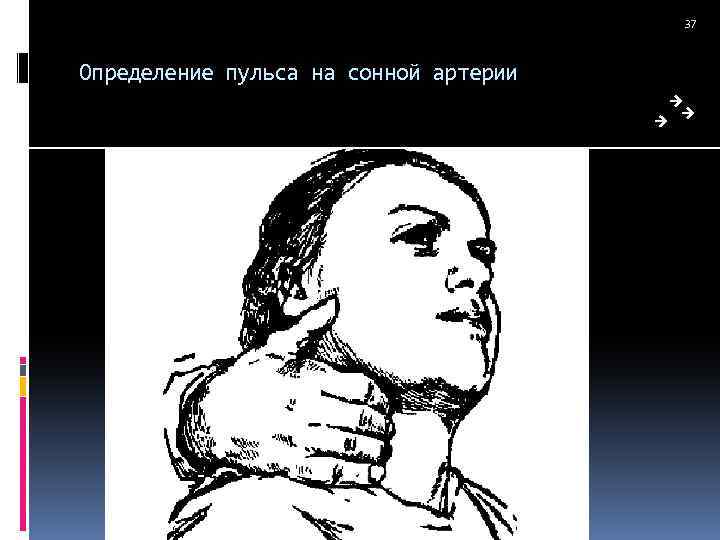 37 Определение пульса на сонной артерии 