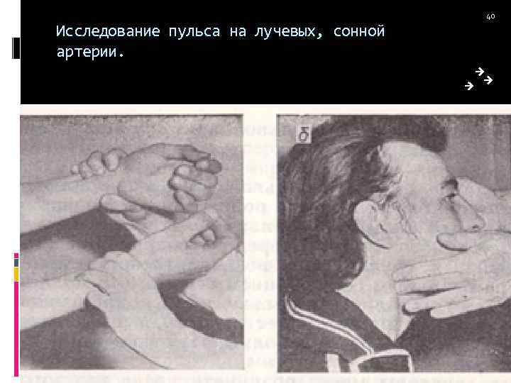 Исследование пульса на лучевых, сонной артерии. 40 