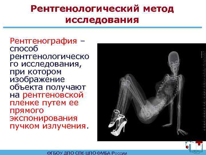 Рентген определит рентген. Методика анализа рентгеновских снимков. Рентгенологические методы исследования. Рентгенологический метод исследования. Методики рентгенологического исследования.