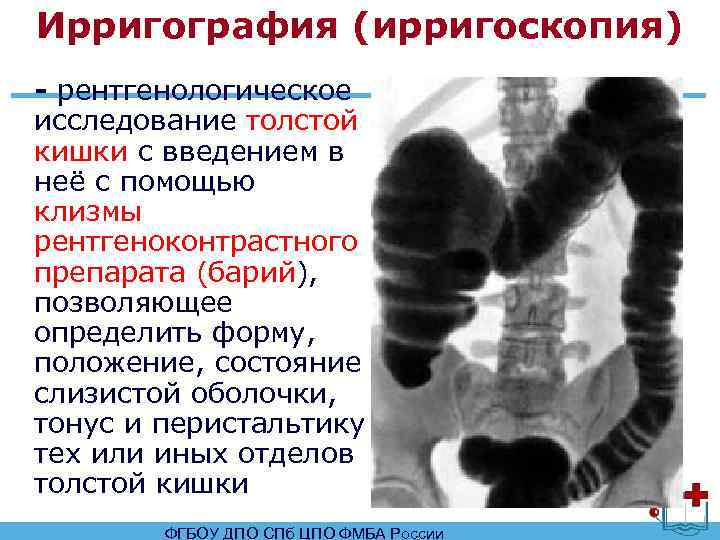 Ирригоскопия почек