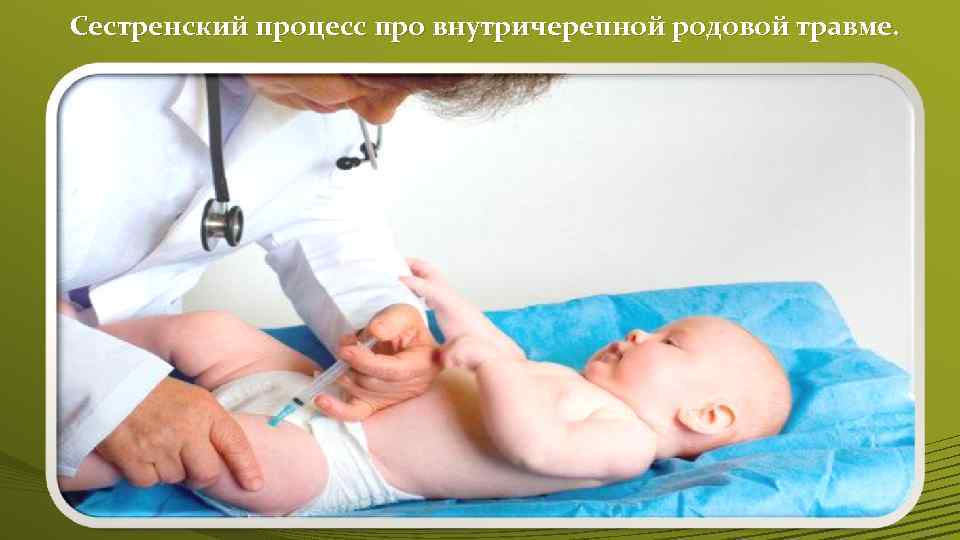 Сестренский процесс про внутричерепной родовой травме. 