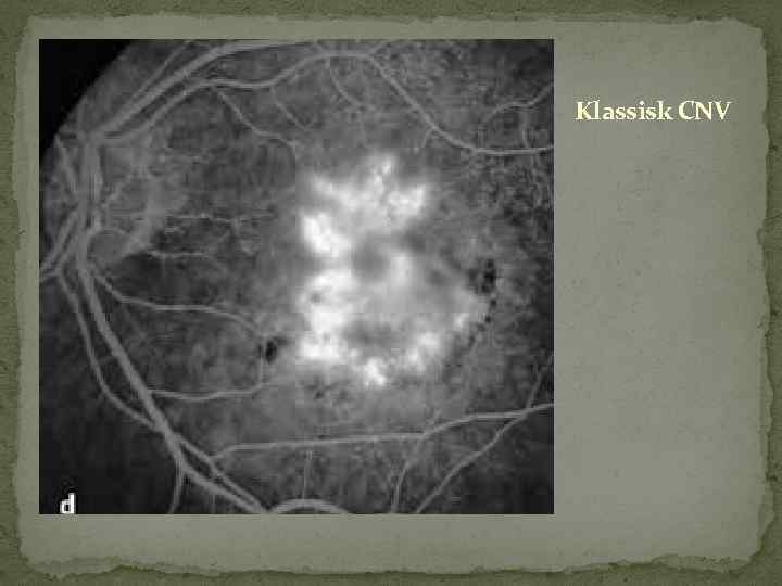 Klassisk CNV 