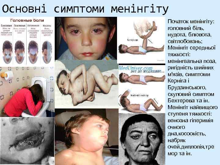 Основні симптоми менінгіту Початок менінгіту: головний біль, нудота, блювота, світлобоязнь; Менінгіт середньої тяжкості: менінгеальна