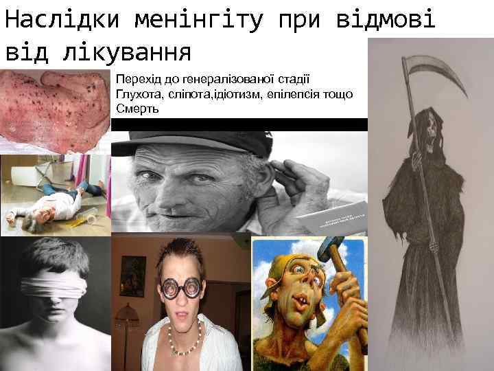 Наслідки менінгіту при відмові від лікування Перехід до генералізованої стадії Глухота, сліпота, ідіотизм, епілепсія