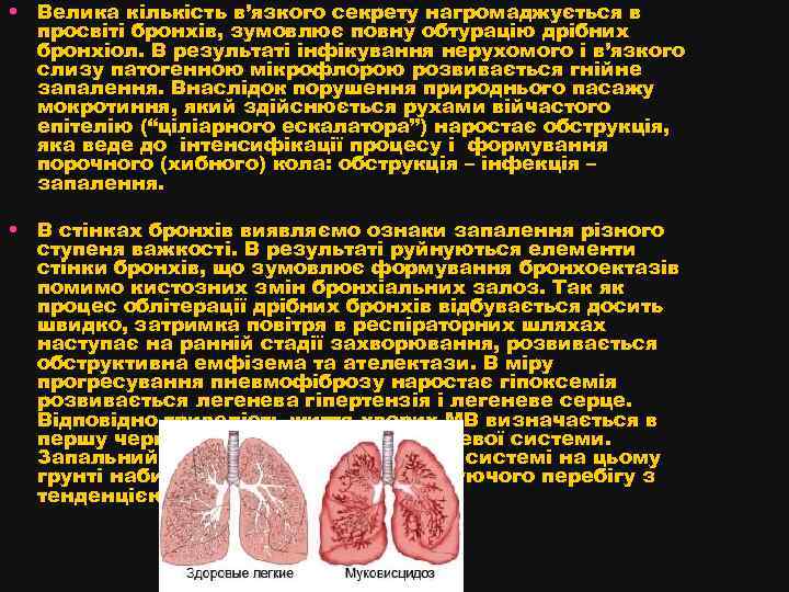  • Велика кількість в’язкого секрету нагромаджується в просвіті бронхів, зумовлює повну обтурацію дрібних