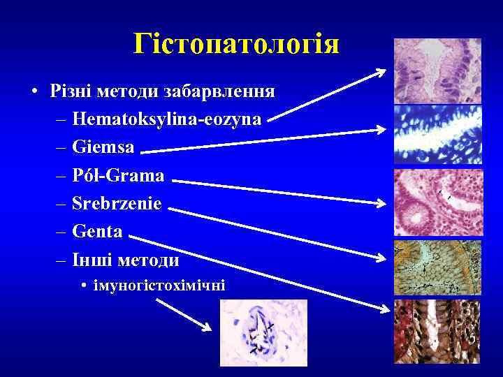 Гістопатологія • Різні методи забарвлення – Hematoksylina-eozyna – Giemsa – Pół-Grama – Srebrzenie –