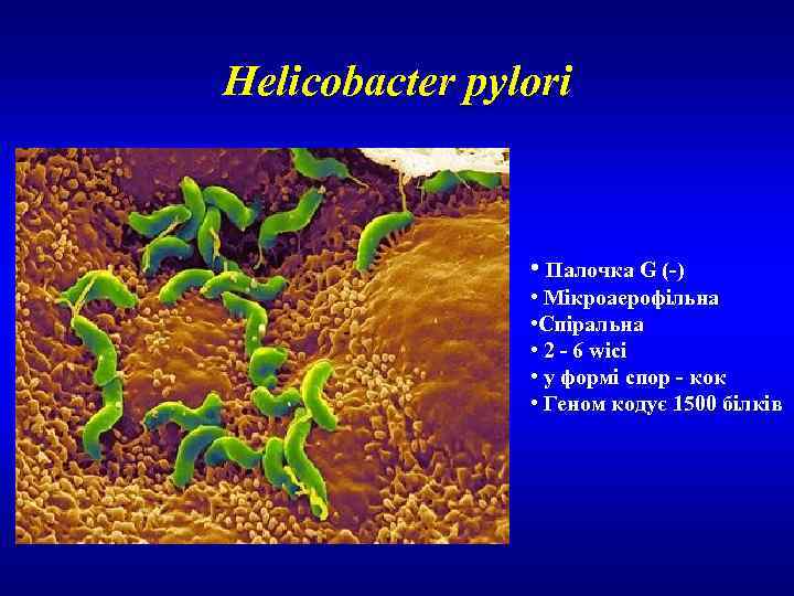Helicobacter pylori • Палочка G (-) • Мікроаерофільна • Спіральна • 2 - 6