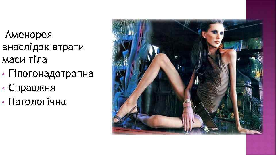 Аменорея внаслідок втрати маси тіла • Гіпогонадотропна • Справжня • Патологічна 