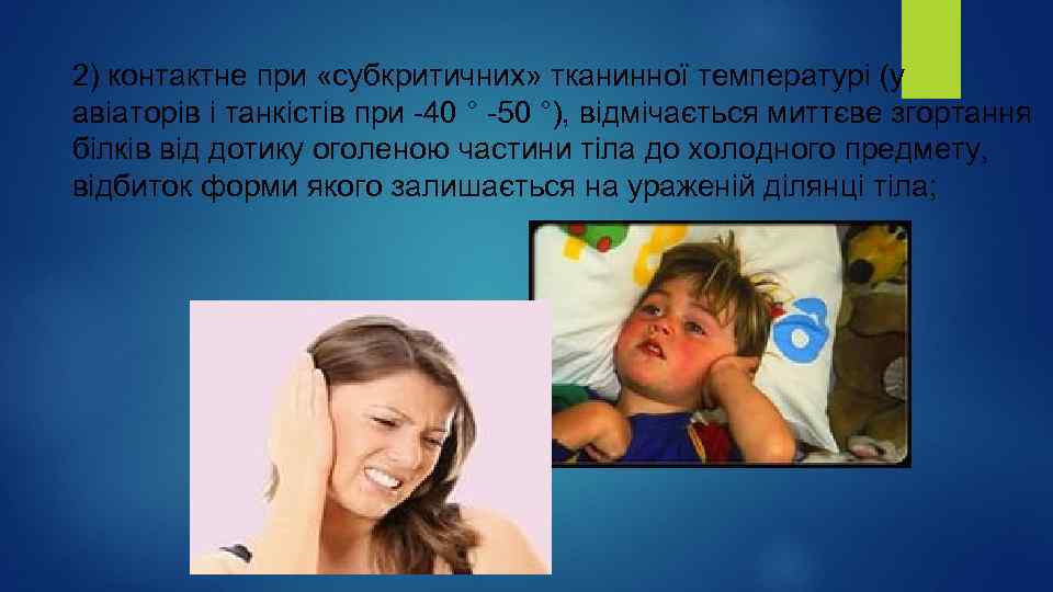 2) контактне при «субкритичних» тканинної температурі (у авіаторів і танкістів при -40 ° -50