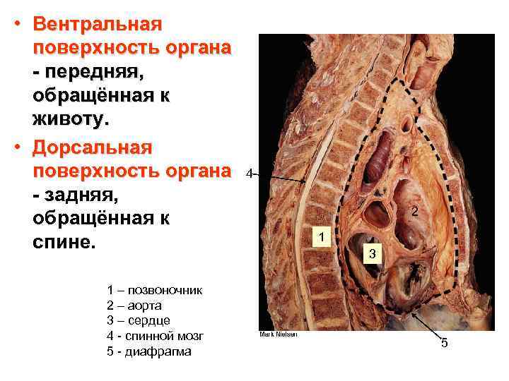  • Вентральная поверхность органа - передняя, обращённая к животу. • Дорсальная поверхность органа