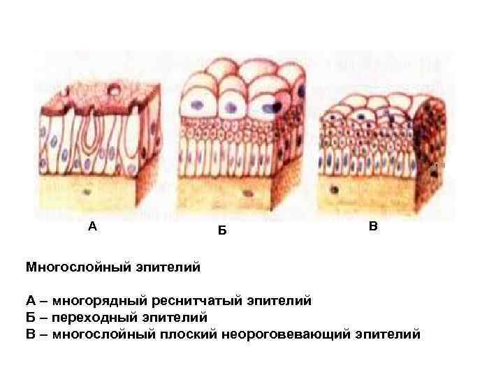 А Б В Многослойный эпителий А – многорядный реснитчатый эпителий Б – переходный эпителий