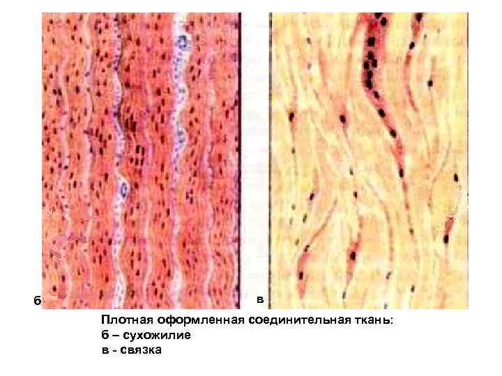 б в Плотная оформленная соединительная ткань: б – сухожилие в - связка 