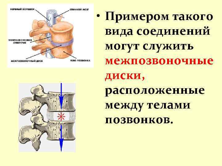 Кости позвоночника тип соединения. Межпозвоночные суставы Тип соединения. Межпозвонковый диск вид сустава. Межпозвоночные диски соединение. Соединения между телами позвонков.