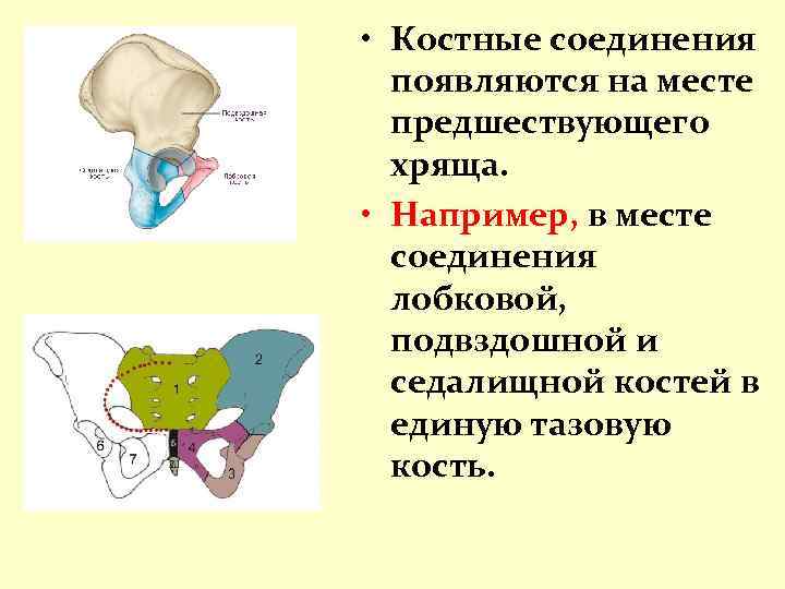  • Костные соединения появляются на месте предшествующего хряща. • Например, в месте соединения