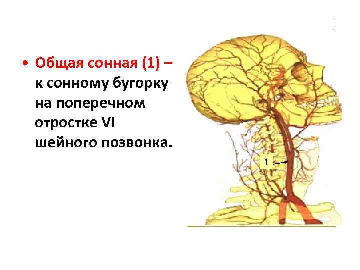  • Общая сонная (1) – к сонному бугорку на поперечном отростке VI шейного