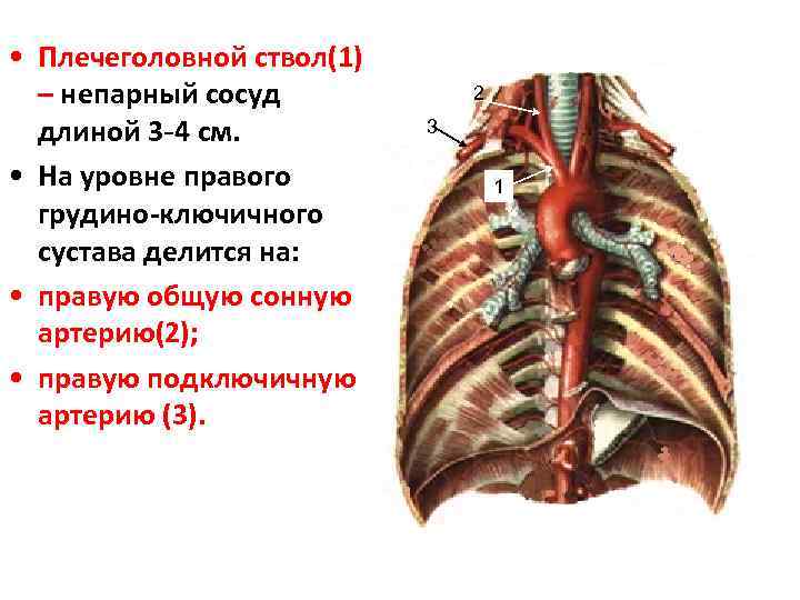  • Плечеголовной ствол(1) – непарный сосуд длиной 3 -4 см. • На уровне