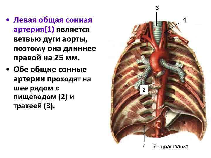 Где сонные артерии у человека на шее фото