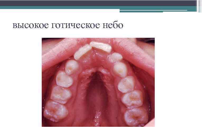 высокое готическое небо 