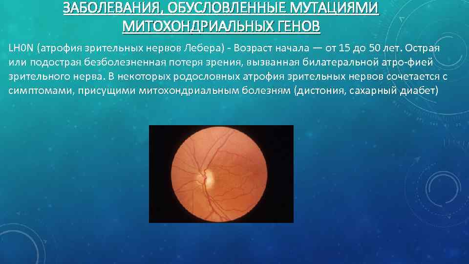 ЗАБОЛЕВАНИЯ, ОБУСЛОВЛЕННЫЕ МУТАЦИЯМИ МИТОХОНДРИАЛЬНЫХ ГЕНОВ LH 0 N (атрофия зрительных нервов Лебера) Возраст начала