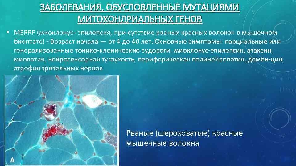 Митохондриальные болезни презентация