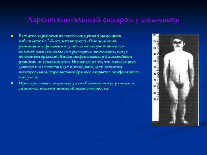 Адреногенитальный синдром у мальчиков n n Развитие адреногенитального синдрома у мальчиков наблюдается с 2