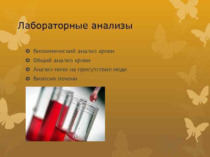 Лабораторные анализы Биохимический анализ крови Общий анализ крови Анализ мочи на присутствие меди Биопсия