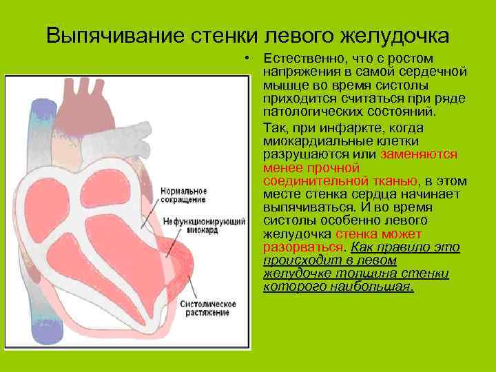 Изменение передней стенки левого желудочка. Стенки левого желудочка сердца. Гипокинез левого желудочка. Гипокинез стенок левого желудочка. Задняя нижняя стенка сердца.