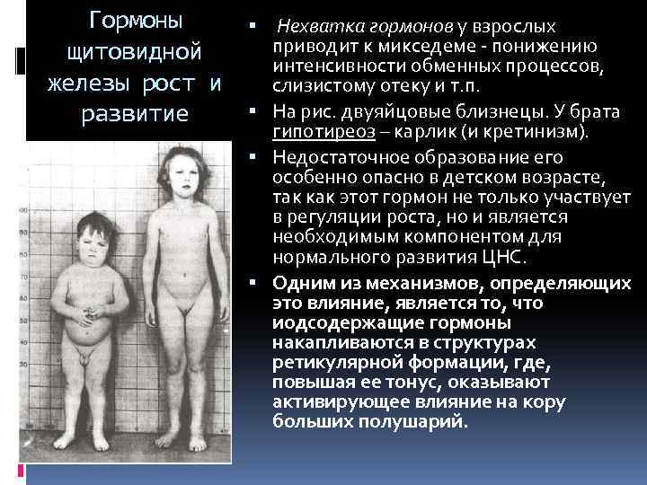 Гормоны щитовидной железы рост и развитие Нехватка гормонов у взрослых приводит к микседеме -