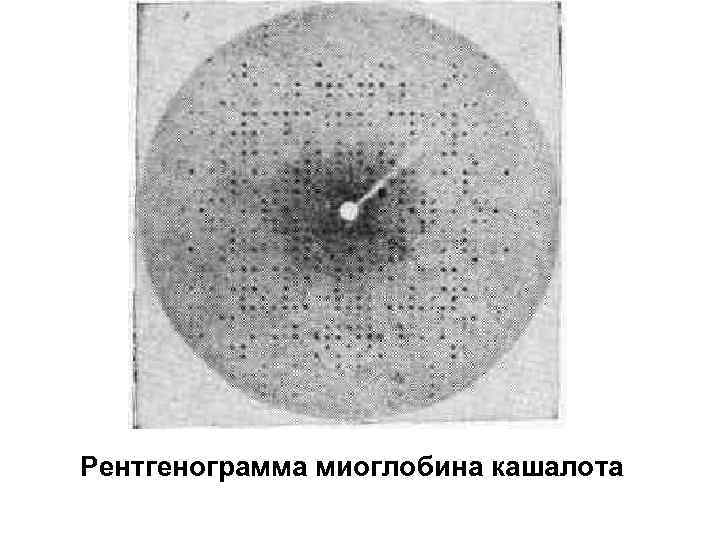Рентгенограмма миоглобина кашалота 