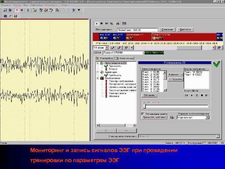 Мониторинг и запись сигналов ЭЭГ при проведении тренировки по параметрам ЭЭГ 