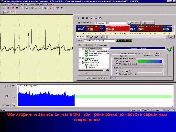 Мониторинг и запись сигнала ЭКГ при тренировке по частоте сердечных сокращений 