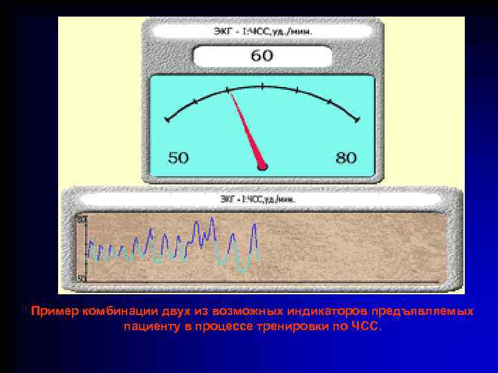 Пример комбинации двух из возможных индикаторов предъявляемых пациенту в процессе тренировки по ЧСС. 