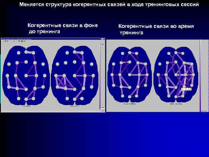 Меняется структура когерентных связей в ходе тренинговых сессий Когерентные связи в фоне до тренинга