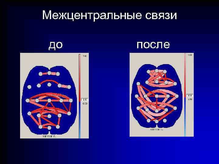 Межцентральные связи до после 