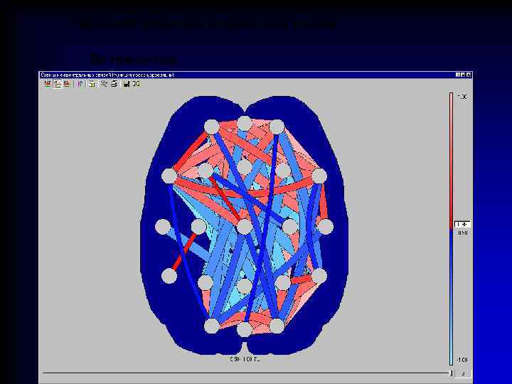 Меняется структура когерентных связей До тренингов 